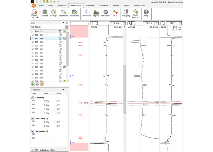 magnifi5-with-ai-chart-01.png magnifi5-with-ai-chart-01.png