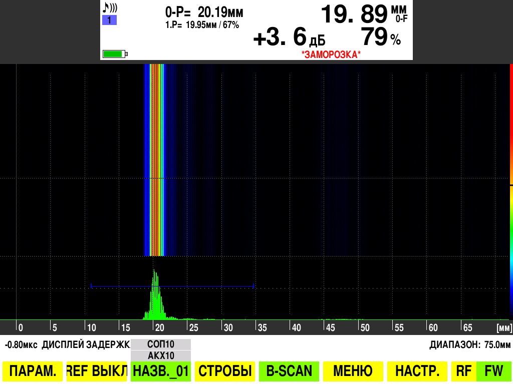 B-Scan